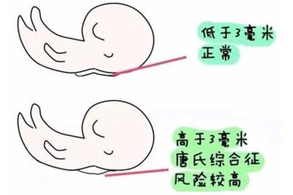 不要让你的孩子生活在无声的世界里，你必须了