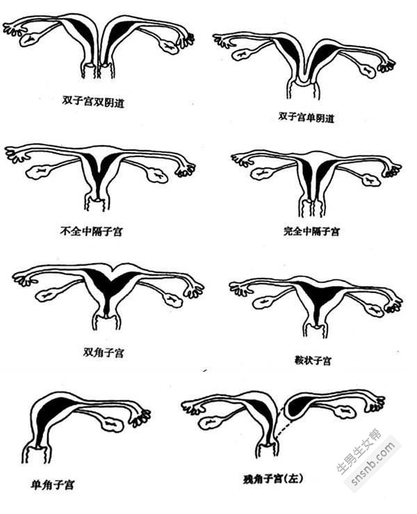 异常子宫的症状是什么？正常的子宫是什么样子的？