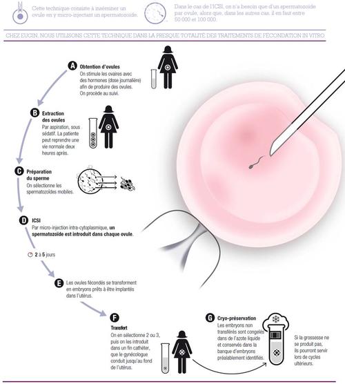 杭州哪里做试管婴儿好一点-试管婴儿可以在绥化市妇幼保健院进行吗？来看看这些条件是否满足？