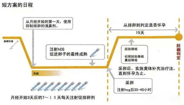 重庆助孕公司花费：长和短的体外物理刺激方案的区别